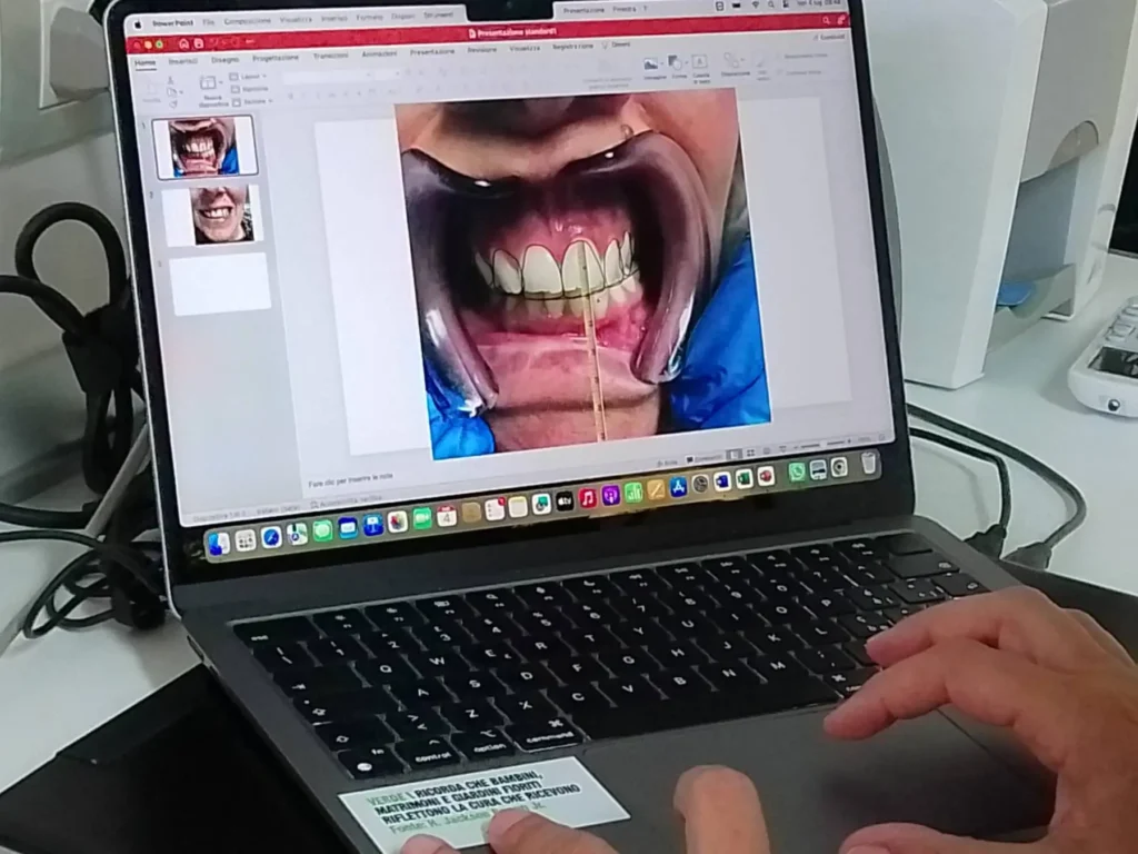 Dott.ssa Irene D'Errico - studio dentistico a Casarano